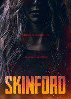 Skinford
