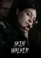 Skin Walker