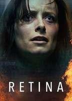 Retina