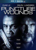 Puncture Wounds