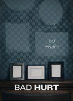 Bad Hurt