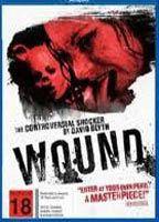 Wound