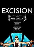 Excision