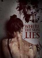 Where the Skin Lies
