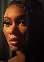 Winnie Harlow