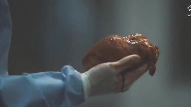 Pathology scene 4