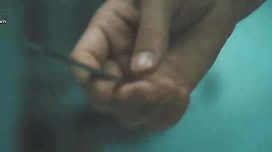 Pathology scene 10
